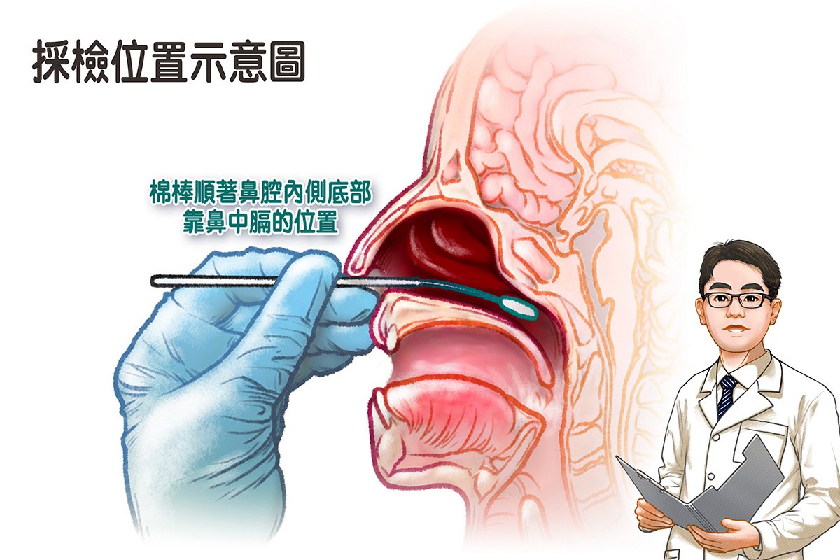 家用快篩判讀 慈濟感染科醫師建議15分鐘為度 1 確實掌握快篩棒進入鼻腔的位置,檢測結果才會準確。