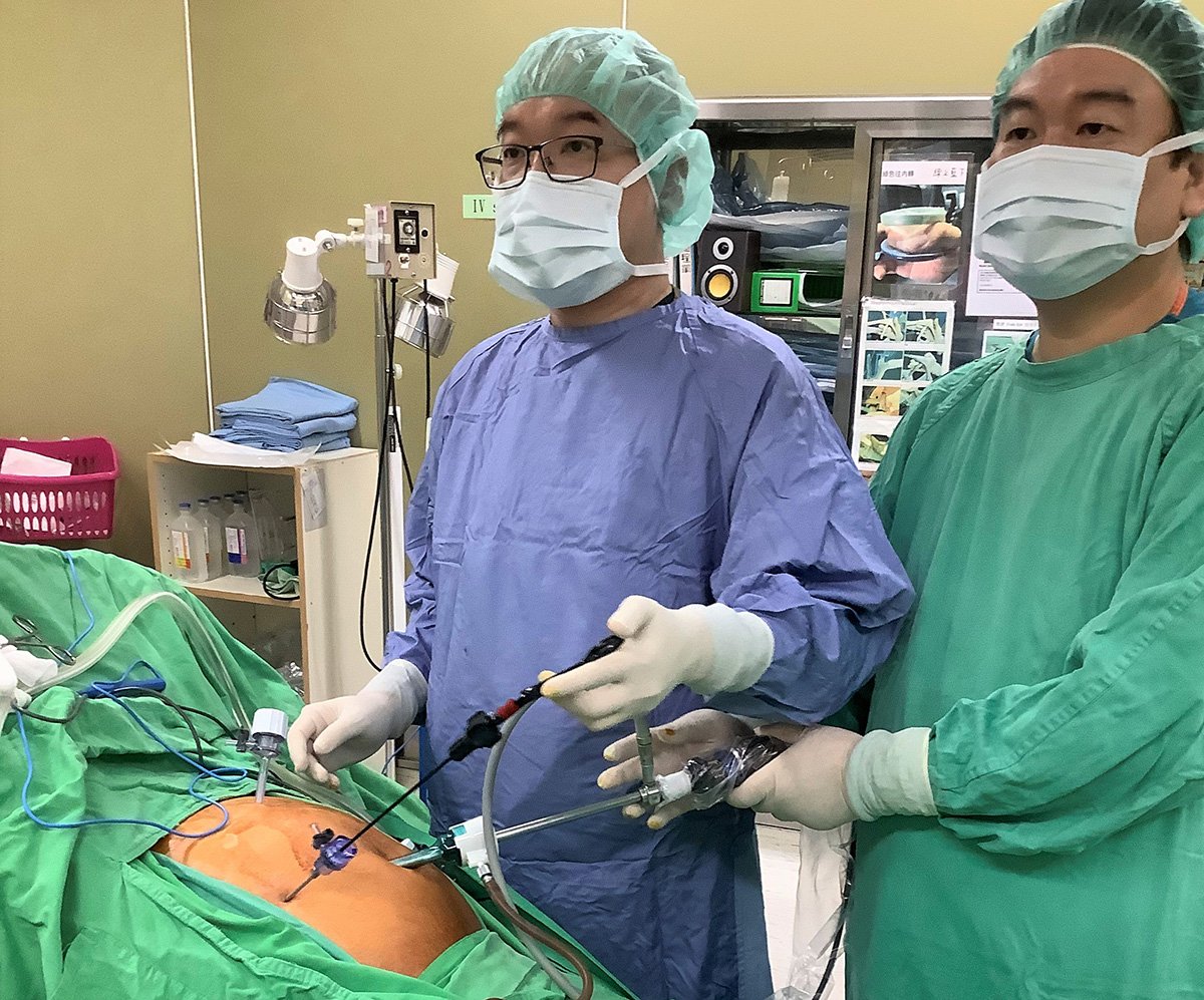臨床罕見:自發性小腸壁血腫 竹秀成功治療並發表國際期刊 1 手術照1
