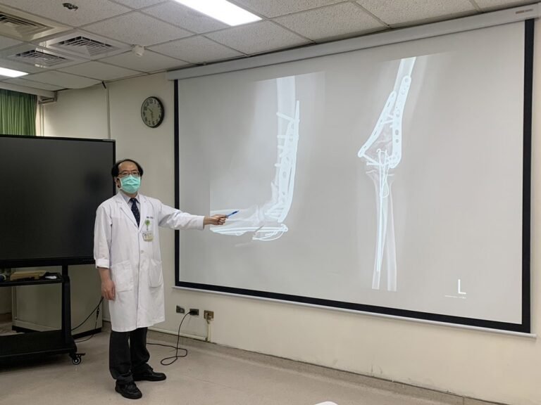 黃敏旭主任幫她進行X光與3D立體攝影後，發現是遠左手端肱骨粉碎性骨折