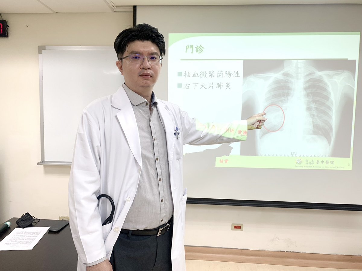 衛生福利部台中 醫院家醫科醫師張祐維說明女大生感冒一週後道院右下感染一大片肺炎的狀況。