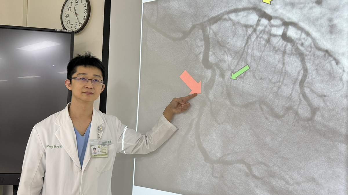 34歲男打手遊突胸痛 三條血管阻塞險喪命 醫:年輕族群心肌梗塞攀升 1 S 8200224