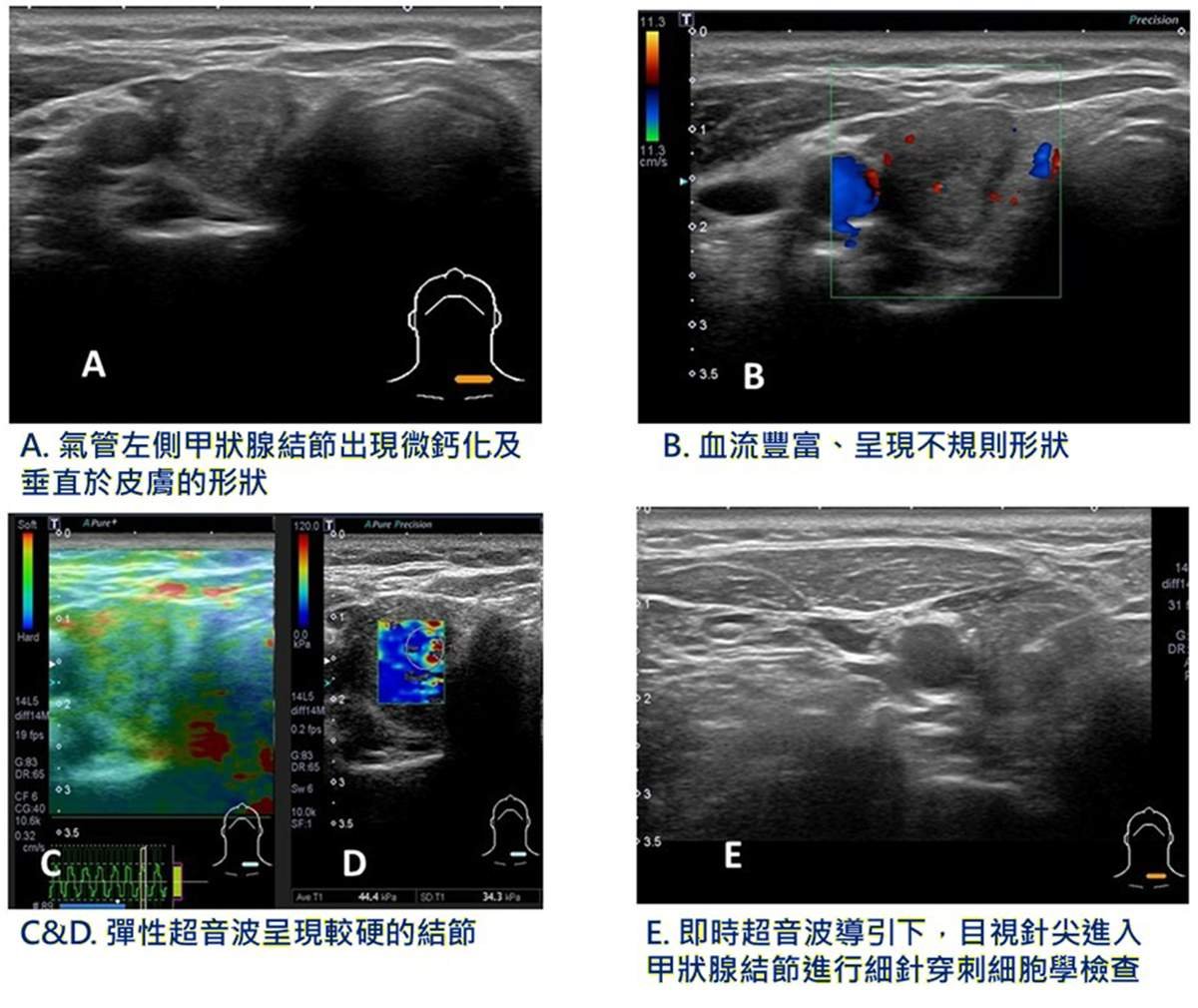 line oa chat 260423 104404