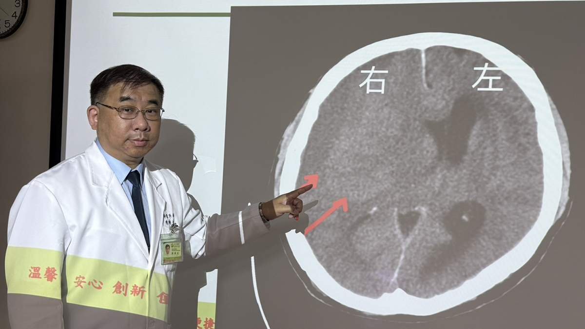 左手左腳無力竟非中風 水果行老闆腦出血及時手術保住行動力 2 S 10862711