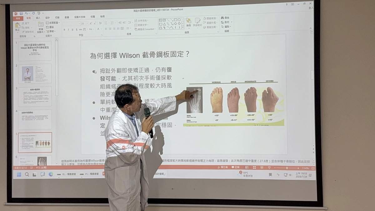 登山常腳痛竟是拇趾外翻 62歲男截骨手術矯正重返山林 2 S 12001380