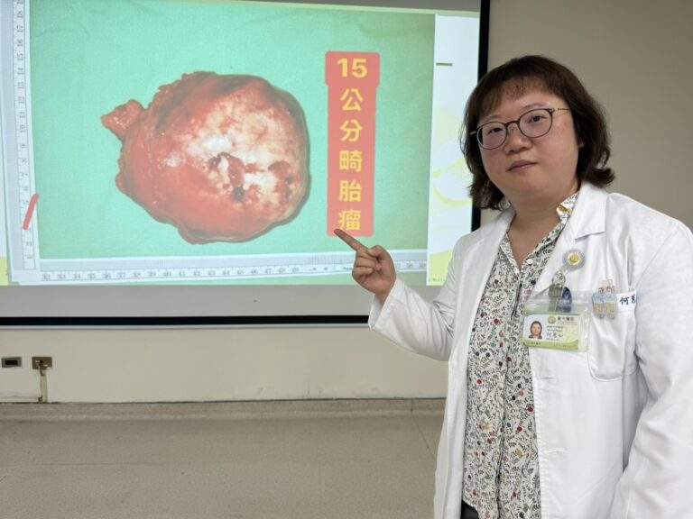 24歲女子求職健檢意外發現15公分縱膈腔腫瘤，經胸腔鏡手術完整切除，病理確認為良性畸胎瘤。